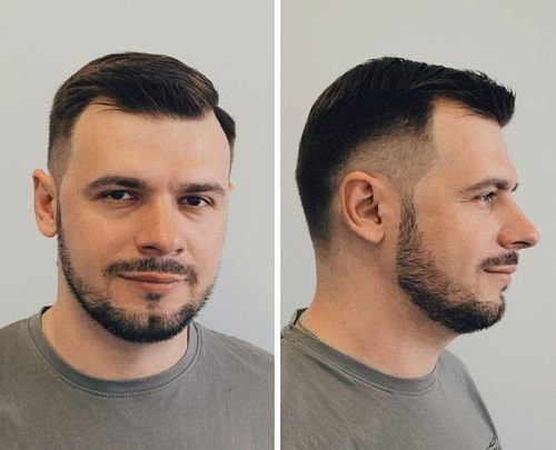 50 Classy Haircuts and Hairstyles for Balding Men