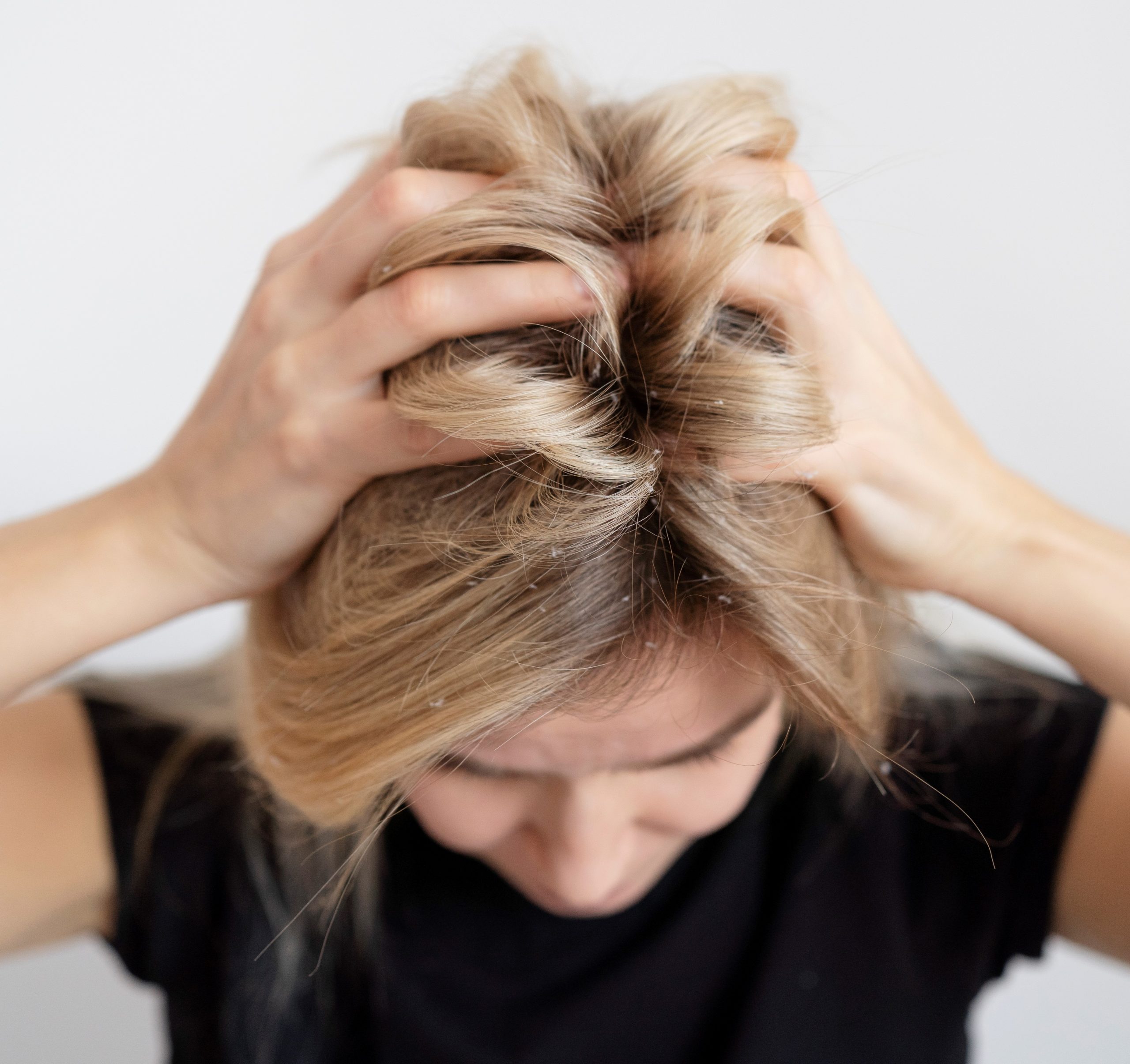 5 Best Shampoos for Itchy Scalp, According to Master Trichologist